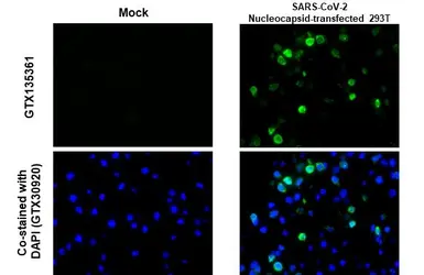 Anti-SARS-CoV-2 (COVID-19) Nucleocapsid antibody used in IHC-P (cell pellet) (IHC-P (cell pellet)). GTX135361