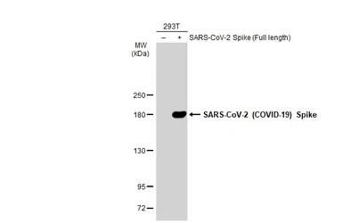 Anti-SARS-CoV-2 (COVID-19) Spike RBD antibody used in Western Blot (WB). GTX135385