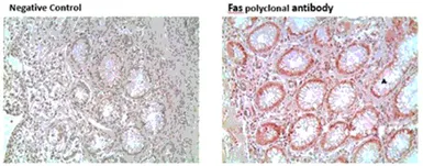 Anti-Fas antibody used in IHC (Paraffin sections) (IHC-P). GTX13550