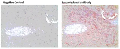 Anti-Fas antibody used in IHC (Paraffin sections) (IHC-P). GTX13550