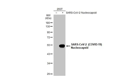 Anti-SARS-CoV-2 (COVID-19) Nucleocapsid antibody used in Western Blot (WB). GTX135570