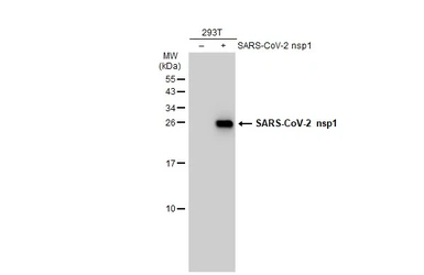 Anti-SARS-CoV-2 (COVID-19) nsp1 antibody used in Western Blot (WB). GTX135612