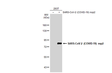 Anti-SARS-CoV-2 (COVID-19) nsp2 antibody used in Western Blot (WB). GTX135717