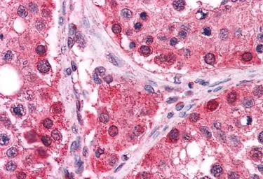 Anti-TrxR1 antibody, C-term used in IHC (Paraffin sections) (IHC-P). GTX13574