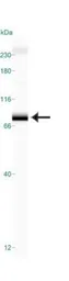 Anti-TRF2 antibody [4A794.15] used in Western Blot (WB). GTX13579