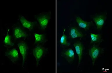 Anti-MURF1 antibody used in Immunocytochemistry/ Immunofluorescence (ICC/IF). GTX135929