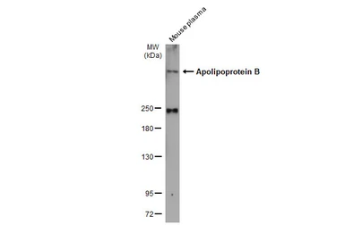 Anti-Apolipoprotein B antibody used in Western Blot (WB). GTX135994
