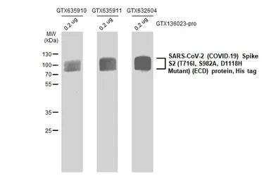 SARS-CoV-2 (COVID-19) Spike S2 (ECD) Protein, B.1.1.7 / Alpha variant, His tag. GTX136023-pro