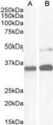 Anti-PAX8 antibody, N-term used in Western Blot (WB). GTX13611