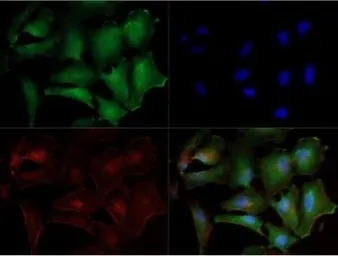 Anti-Noxa antibody [114C307.1] used in Immunocytochemistry/ Immunofluorescence (ICC/IF). GTX13654
