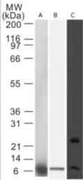 Anti-Noxa antibody [114C307.1] used in Western Blot (WB). GTX13654