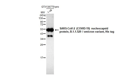 SARS-CoV-2 (COVID-19) Nucleocapsid protein, Omicron / BA.1 variant, His tag. GTX136779-pro