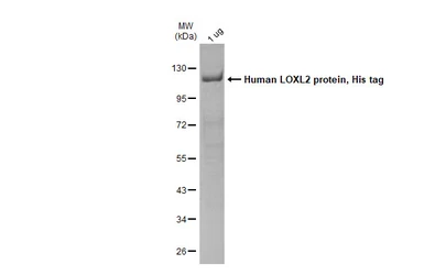 Human LOXL2 protein, His tag. GTX136930-pro