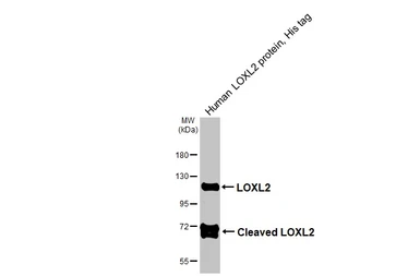 Human LOXL2 protein, His tag. GTX136930-pro