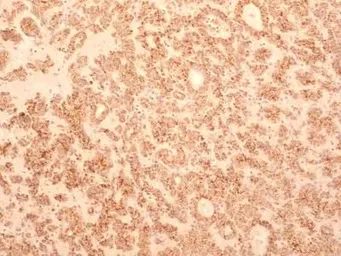 Anti-TEM8 antibody [200C1339(SB20)] used in IHC (Paraffin sections) (IHC-P). GTX13798