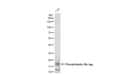 Human Procalcitonin protein, His tag. GTX138116-pro