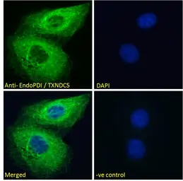 Anti-TXNDC5 antibody, C-term used in Immunocytochemistry/ Immunofluorescence (ICC/IF). GTX13820