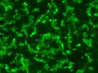 Anti-RPE65 antibody [401.8B11.3D9] used in Immunocytochemistry/ Immunofluorescence (ICC/IF). GTX13826