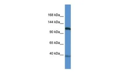 Anti-Myocardin antibody, N-term used in Western Blot (WB). GTX13842