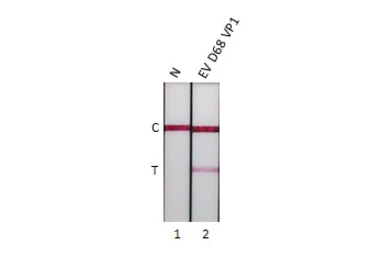 Enterovirus D68 VP1 protein, His tag. GTX138561-pro