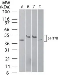 Anti-5-HT7 receptor antibody used in Western Blot (WB). GTX13898