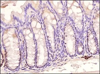 Anti-TLR3 antibody [40C1285.6] used in IHC (Paraffin sections) (IHC-P). GTX13915