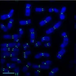 Anti-CENPA antibody [3-19] used in Immunocytochemistry/ Immunofluorescence (ICC/IF). GTX13939