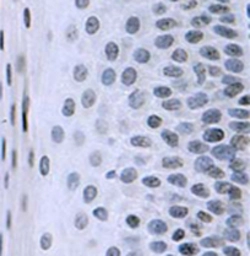 Anti-CENPA antibody [3-19] used in IHC (Paraffin sections) (IHC-P). GTX13939
