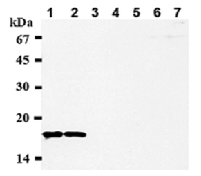 Anti-CENPA antibody [3-19] used in Western Blot (WB). GTX13939