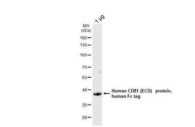 Human CD81 (ECD) protein, human Fc tag. GTX144106-pro