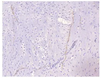 Anti-PDE4A antibody used in IHC (Paraffin sections) (IHC-P). GTX14607