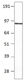 Anti-PDE7B antibody used in Western Blot (WB). GTX14617