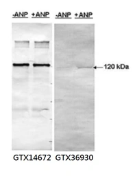Anti-PDE5A antibody used in Western Blot (WB). GTX14672