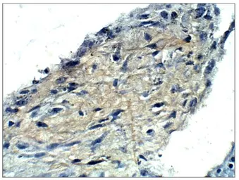 Anti-MUC1 antibody used in IHC (Paraffin sections) (IHC-P). GTX14690