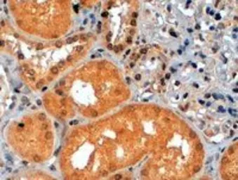 Anti-p70 S6K antibody, C-term used in IHC (Paraffin sections) (IHC-P). GTX14708