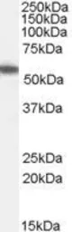 Anti-ETEA antibody, C-term used in Western Blot (WB). GTX14759
