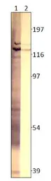 Anti-ADCY3 antibody used in Western Blot (WB). GTX14778