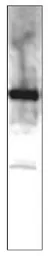 Anti-MERTK antibody used in Western Blot (WB). GTX14919