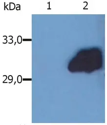 Anti-SOCS3 antibody [SO1] used in Western Blot (WB). GTX14939