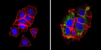 Anti-BCAP31 antibody [CC-1] used in Immunocytochemistry/ Immunofluorescence (ICC/IF). GTX15044