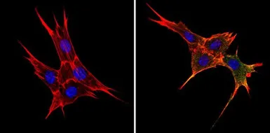 Anti-BCAP31 antibody [CC-1] used in Immunocytochemistry/ Immunofluorescence (ICC/IF). GTX15044