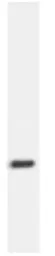 Anti-BCAP31 antibody [CC-4] used in Western Blot (WB). GTX15045
