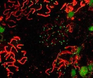 Anti-SCP1 antibody used in Immunocytochemistry/ Immunofluorescence (ICC/IF). GTX15087