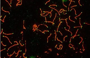 Anti-SCP3 antibody used in Immunocytochemistry/ Immunofluorescence (ICC/IF). GTX15092