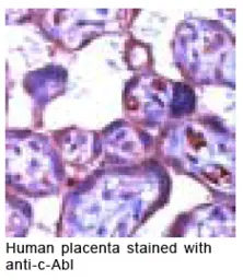 Anti-c-Abl antibody used in Immunohistochemistry (IHC). GTX15130