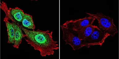 Anti-Presenilin 1 antibody [APS 18] used in Immunocytochemistry/ Immunofluorescence (ICC/IF). GTX15458