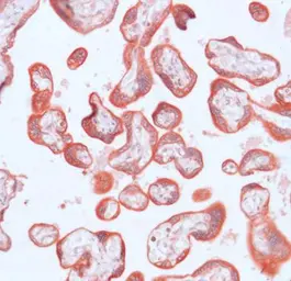 Anti-MMP23 antibody (ready-to-use) used in IHC (Paraffin sections) (IHC-P). GTX15479