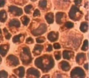 Anti-PRX I antibody used in Immunocytochemistry/ Immunofluorescence (ICC/IF). GTX15571