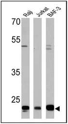Anti-CD58 antibody [TS2/9] used in Western Blot (WB). GTX15669