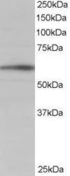 Anti-BAIAP2 (isoform 1) antibody, C-term used in Western Blot (WB). GTX15697